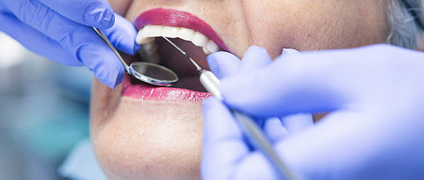 Best Emergency Dentist for Knocked-Out Tooth in Country Knolls, NY